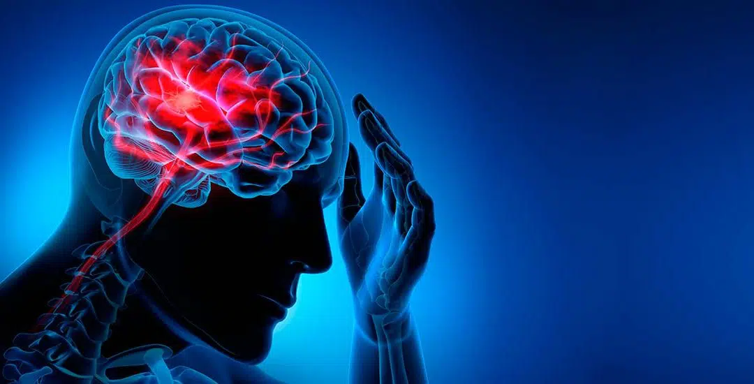 ¿Cuáles son los síntomas que te pueden alertar de un posible ataque cerebral?