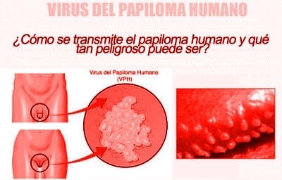 virus del papiloma como se contrae