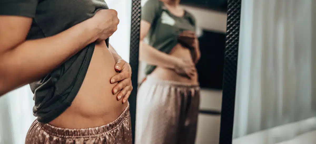 abdomen inflamado despues de comer