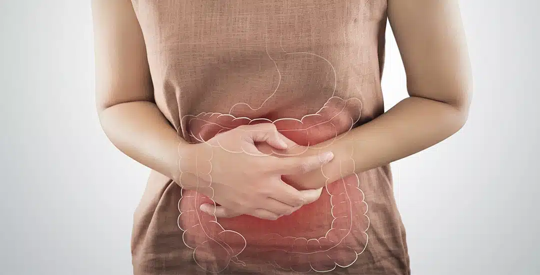 Cáncer de colon: Conoce todo sobre esta enfermedad y cómo prevenirla