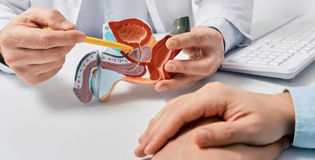 Conoce cómo puedes prevenir el cáncer de próstata