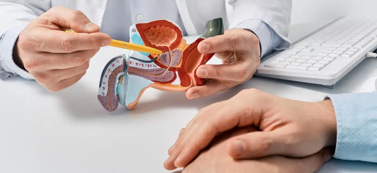 Conoce cómo puedes prevenir el cáncer de próstata