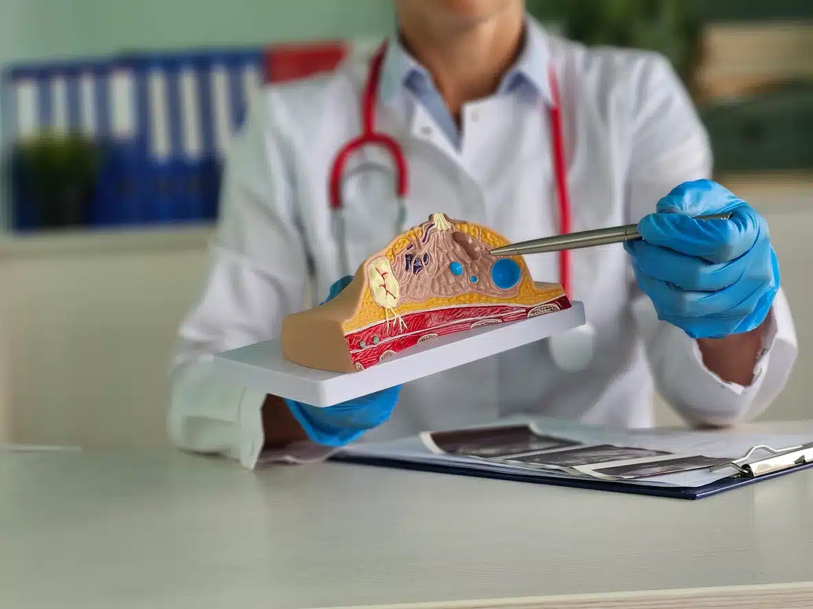 cancer-prevencion cancer-prevencion
