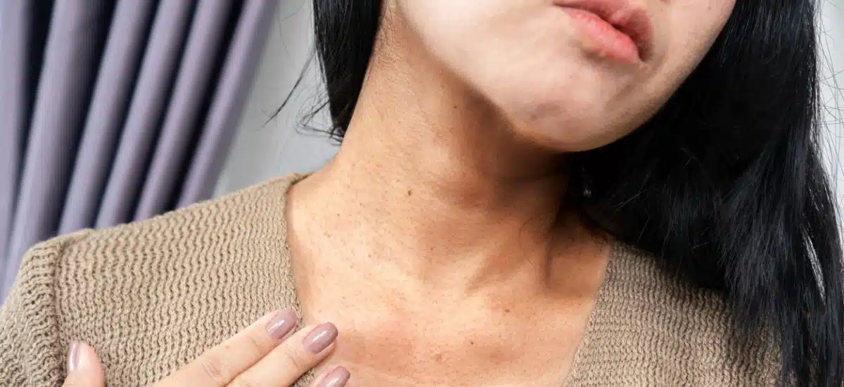 Imagen articulo manchas-en-la-piel