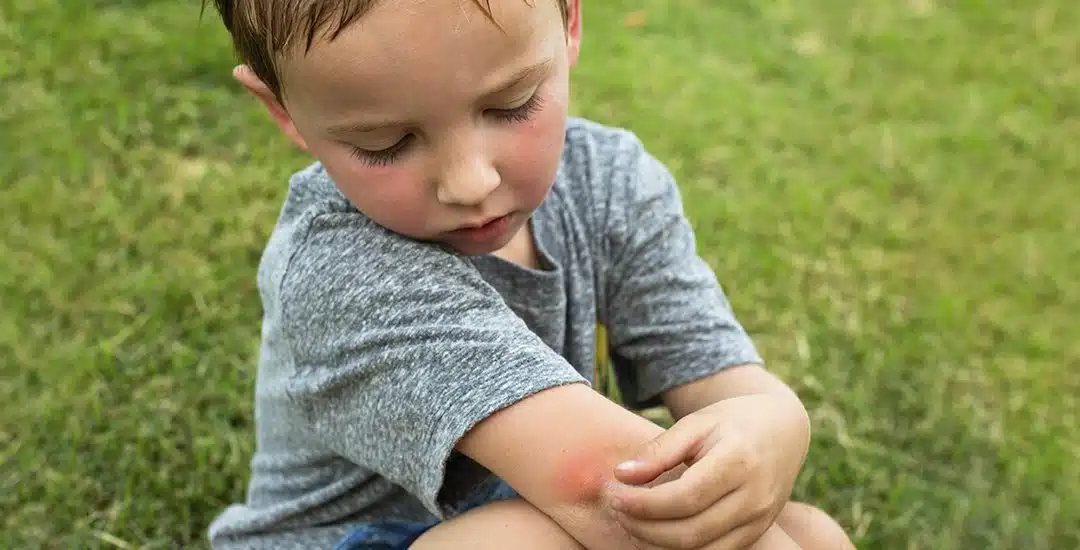 ¿Qué peligros acechan a los niños en verano y cómo cuidarlos?