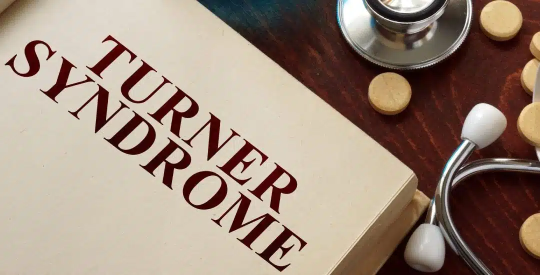 Día Mundial del Síndrome de Turner: concienciar y comprender