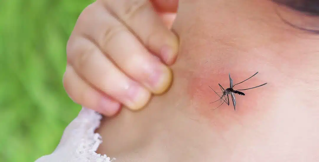 El dengue: síntomas, tratamiento y medidas de prevención